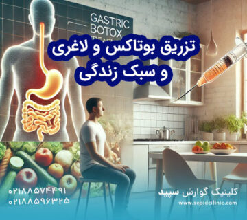 بوتاکس معده و تأثیر آن بر سبک زندگی